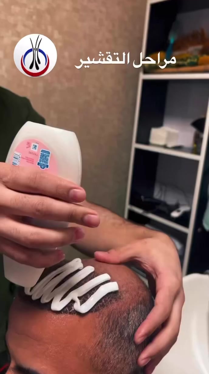 #إذا_اتريد_تغير_حياتك_اليوم_وقتك_تاخذ_القرار_الصح
 👍

#حلمك_بحاجب_كثيف_صار_واقع  🥰

🌹بجلسه وحده ترجع ثقتك بنفسك وتعيش شبابك من جديد 

🌹مع عيادة بان موسى نقدم لكم كافة الامتيازات ♥️

🌹استغل عروض التخفيض الخاصة من عيادة بان موسى لزراعة الشعر وابدأ #رحلة_التغيير_بثقة

#خصومات_مميزة  ✅️
#استشارة_مجانية  ✅️
#متابعة_دقيقة_بعد_الزراعة_بكل_المراحل  ✅️

🔷️🕐 احجز الآن وابدأ التغير الحقيقي 
#ثقتك_بنفسك_تبدأ_من_شعرك 💪
 

🔥🔥 عــرض خــاص🔥🔥 

✅️عرض التخفيض الذهبي

                   👇 العـــرض يشـــمل  👇

#كادر_طبي_محترف_وزراعة_شعر_مضمونة
🔷️ ️10 بلازما + 10 ميزو ثيرابي للشعر 💉
🔷️ 4 جلسات بلازما ( تبيض ونضاره للبشره) 
🔷️ حقيبة علاجية متكامله 💊
🔷️ تحاليل وفحوصات قبل العمليه مجاني 
🔷️ العناية بشعر وغسلات مجانيه 🚿
🔷️ معاينه مجانيه لمدة سنة داخل العياده 
🔷️ التخدير بنج موضعي بدون الم 
🔷️ شهادة ضمان مدى الحياة على نجاح العمليه والكثافه 📜

✅️🔥 يتوفر عرض الاقساط 💸
🔷️ القسط الشهري وبدون مقدمه
🔷️ لحاملي بطاقة الماستر كارد الرافدين حصراً
🔷️ استقطاع الكتروني
🔷️ لجميع الموظفين والمتقاعدين وابطال وزارة الداخلية والدفاع 

✅️🔥 ويوجد لدينا ايضا🥇عرض الملكي ...(ViP)💰 

🔷️العنوان📍بغداد/ المنصور / مقابل مطعم بيستون صمد / عمارة سترونگ/ الطابق الرابع 

🔷️للحجز و الاستفسار التواصـل خاص او على الأرقام التالية ☎️📞

***********
***********
***********

رقم مدير العياده الخاص 
***********
للاستفسار اتصال أو واتس اب 

أهــلا وسهــلآ بــــكم في عيـــادتنا 💙💚
