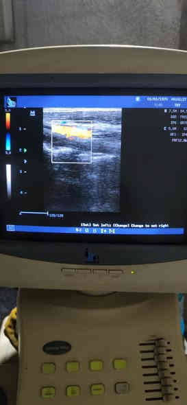 تحية طيبة
يتوفر سونار نوع mindray Dc6 بروب واحد liner
صورتة جدا ممتازة
انتاج 2014
وبسعر جدا جدا مناسب 💥💥💥
للاستفسار واتس اب ***********
او ارسال رسالة على الخاص
#سونار #ايكو #لينير #thiroid #crt #msk #caroted #sup #abdomin #bawoul
