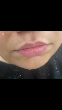 فلر شفايف كوري • أصلي • نتائج طبيعية