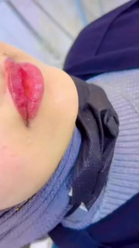 د. هبة عماد / طب الاسنان و دراسات بالتجميل اللاجراحي
استغلوا العروض حالياً 🔥

•  تجميل الوجه (بوتكس-فيلر-خيوط-ميزو)
-حقن ابر نظارة و تفتيح البشرة
•  حشوات علاجية و تجميلية
-ابتسامة هوليود 
•  جراحة الفم و الاسنان
•  تنظيف و تبيض الاسنان
•  معالجات و ترميم الاسنان التالفة 

للحجز : ***********
العنوان : السماوة/ شارع الإسكان/ مركز الريماس
حساب الأنستا 👇🏻
https://www.instagram.com/dr.heba_clinic?igsh=MTZ3d3c1c2dycjA5OA%3D%3D&utm_source=qr
