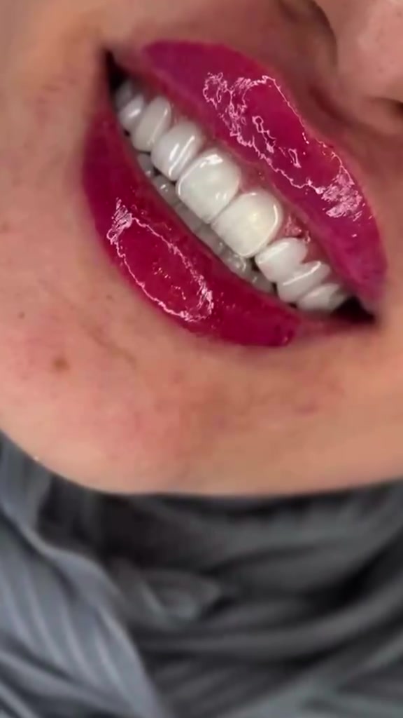 خلي ملامحك تضوي بضحكة تجذب الأنظار من أول ثانية! 🦷

📲 راسلنا مباشرة عبر الواتساب لحجز موعدك: ***********
📍 العنوان: بغداد - الحسينية - شارع 20 - مجاور السوق
