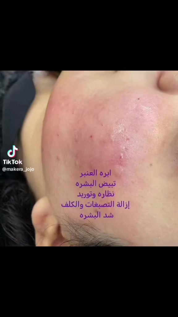 الكل يدلل


**إذا كنت صاحب هذا الإعلان وتريد حذفه لأي سبب، رجاءا أرسل رسالة إلى الدعم الفني**