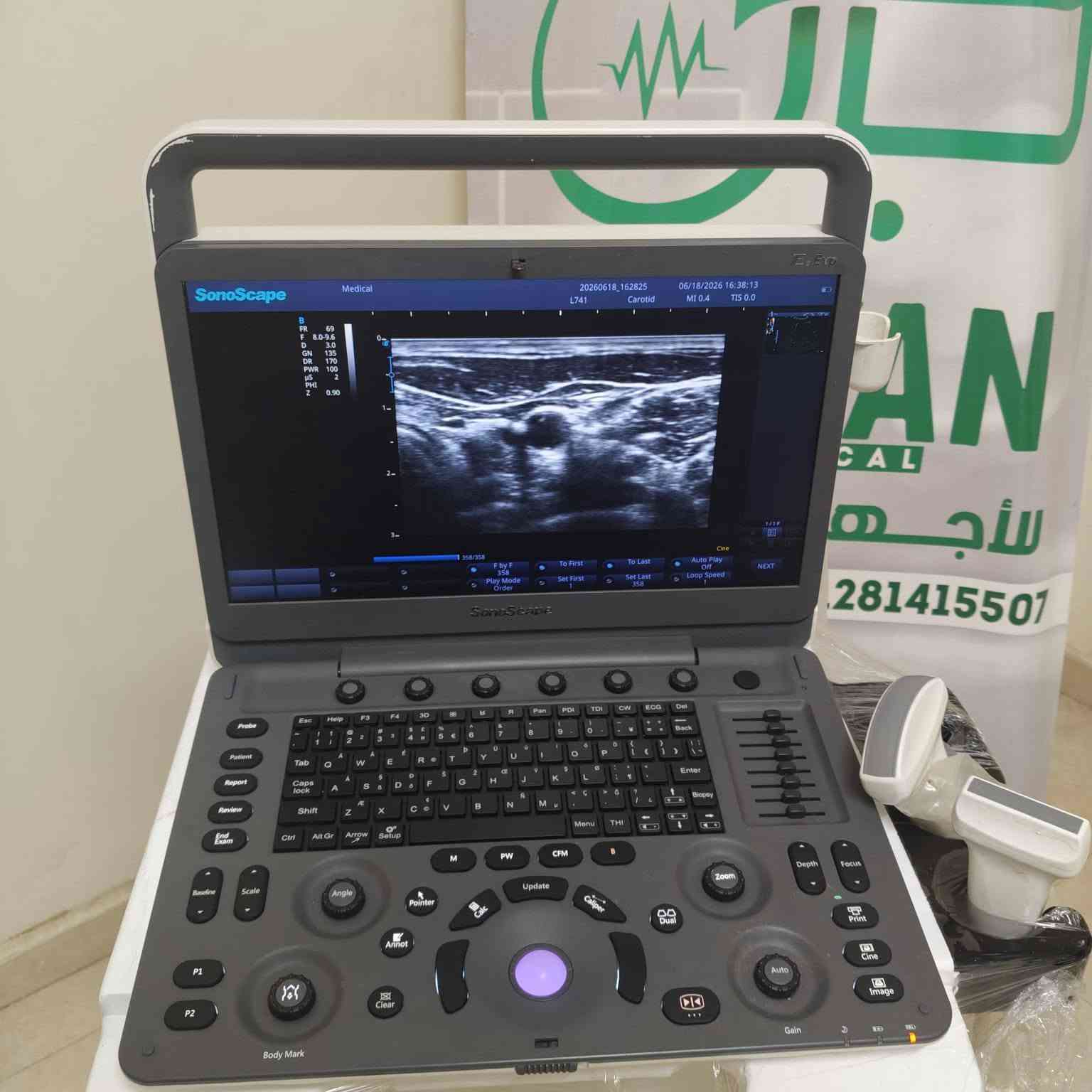 🔥 سونسكيب E1 Exp Color Doppler 🔥
✅ Color Doppler
✅ بروب كونفكس + لينير
✅ جاهز للعمل فورًا
✅ حالة ممتازة

📩 للتواصل خاص أو واتساب:
01035163941
01114878515


**إذا كنت صاحب هذا الإعلان وتريد حذفه لأي سبب، رجاءا أرسل رسالة إلى الدعم الفني**