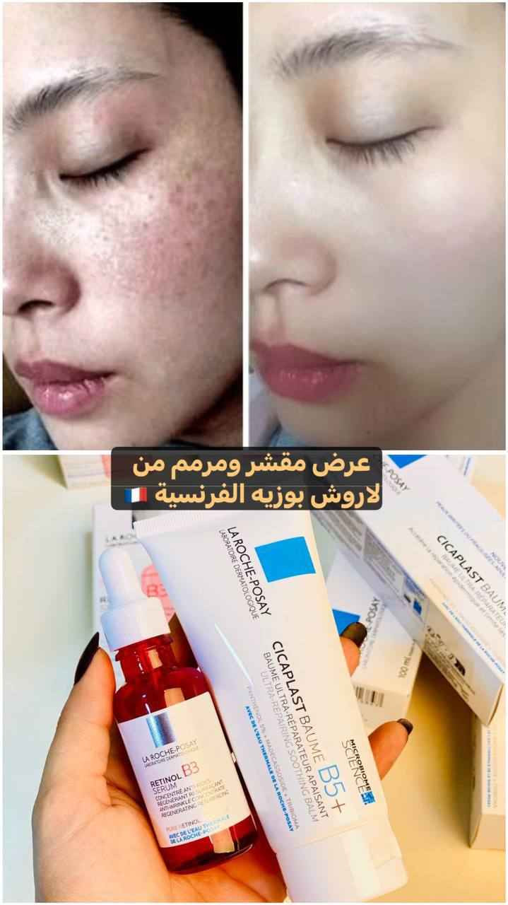🎀عرض خاص🇫🇷🎀
عرض اشراق وتقشير وتجديد خلايا البشرة وترطيب ونعومة البشرة يقوي حاجز البشرة ويحارب التجاعيد يتكون من 👈 سيروم B3 + كريم سيكابلاست من لاروش بوزيه الفرنسية 🇫🇷 

❤️سيروم ريتينول من لاروش بوزيه الاول من مجموعة سيرومات لاروش 
✔يعمل الريتنول على منع ظهور علامات التقدم بالسن ، عبر  تحفيز الكولاجين وبالتالي يقلل من ظهور التجاعيد والخطوط الدقيقه 
✔يعمل الريتنول على البقع الداكنه و  التصبغات و توحيد لون البشره 
✔ يرطيب الجلد ويقلل من تهيج البشره ويقلل من ظهور حب الشباب ، و زيادة اشراقه البشره بعد اسبوعين 💪

❤️كريم سيكابلاست B5 من لاروش بوزيه الفرنسية🇫🇷 الأصلية واحد من أشهر المنتجات الطبية التي أطلقتها الشركة الفرنسية من لاروش بوزيه 🇨🇵
🌸 ملطف ومرطب للبشرة
🌸 تقوية حاجز البشرة 
🌸 مرمم قوي خاصة بعد التقشير 
🌸 بيخفي أثار اي ندوب حب الشباب 
🌸 بيقلل من الخطوط التعبيرية ما بيخفيها 
🌸 نضارة بشرة رائعة
منشأ العرض فرنسي 🇫🇷 أربيل, العراق


**إذا كنت صاحب هذا الإعلان وتريد حذفه لأي سبب، رجاءا أرسل رسالة إلى الدعم الفني**