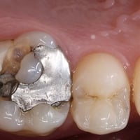 عيادة الطائي • طب الاسنان • سبع البور