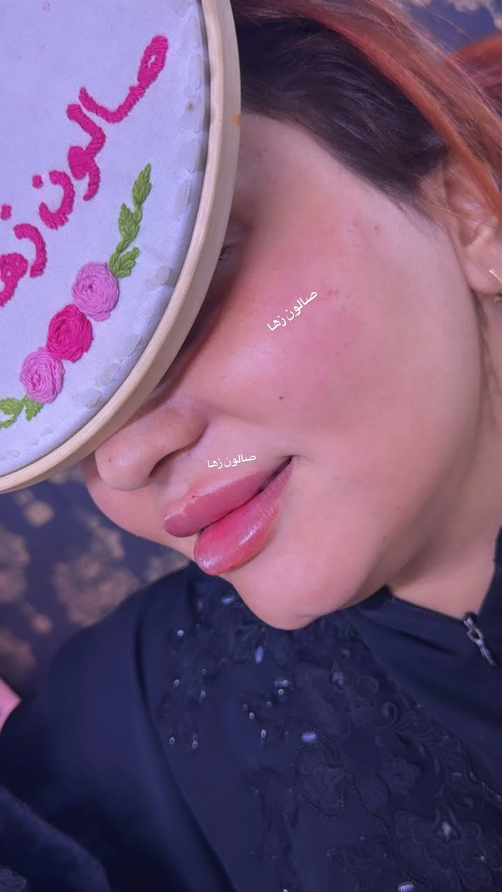 عرض بكج أميرات صالون زها 

جلسه نضاره مع فلر اودري تغير شامل 12 سيسي ب 200 الف فقط 
جلسه نضاره مع فلر اودري تغير شامل 6 سيسي ب 100 الف فقط 
جلسه نضاره مع فلر اودري تغير شامل 3 سيسي ب 50 الف فقط 

جلسه نضاره مع فلر ابتك تغير شامل 10 سيسي ب 400 
جلسه نضاره مع فلر اراستي تغير شامل 10 سيسي ب 600
جلسه نضاره مع فلر سويسري تغير شامل 10 سيسي ب 800 

فلر شفه اودري ب 25 
فلر شفه ابتك ب 50 
فلر شفه اراستي ب 75 
فلر شفه سويسري ب 100 
فلر شفه الايطالي ب 150 

فلر شفه مع وجنات مع جلسه نضاره ب 75 الف فقط

جلسه نضاره مع تنظيف البشره ب 25 
جلسه نضاره مع تنظيف البشره ب 50 
جلسه نضاره مع تنظيف البشره ب 75 
جلسه نضاره مع تنظيف البشره مع مكس كامل ب 100 
جلسه نضاره مع تنظيف البشره مع مكس كامل ب 125 
جلسه نضاره مع تنظيف البشره مع مكس كامل ب 150 
تفاصيل الجلسات نشرحه الكم بعد المعاينه وننصحكم بالشي التختاروا واليفيدكم

للحجز والاستفسار واتساب *********** ادمونه زهراء
