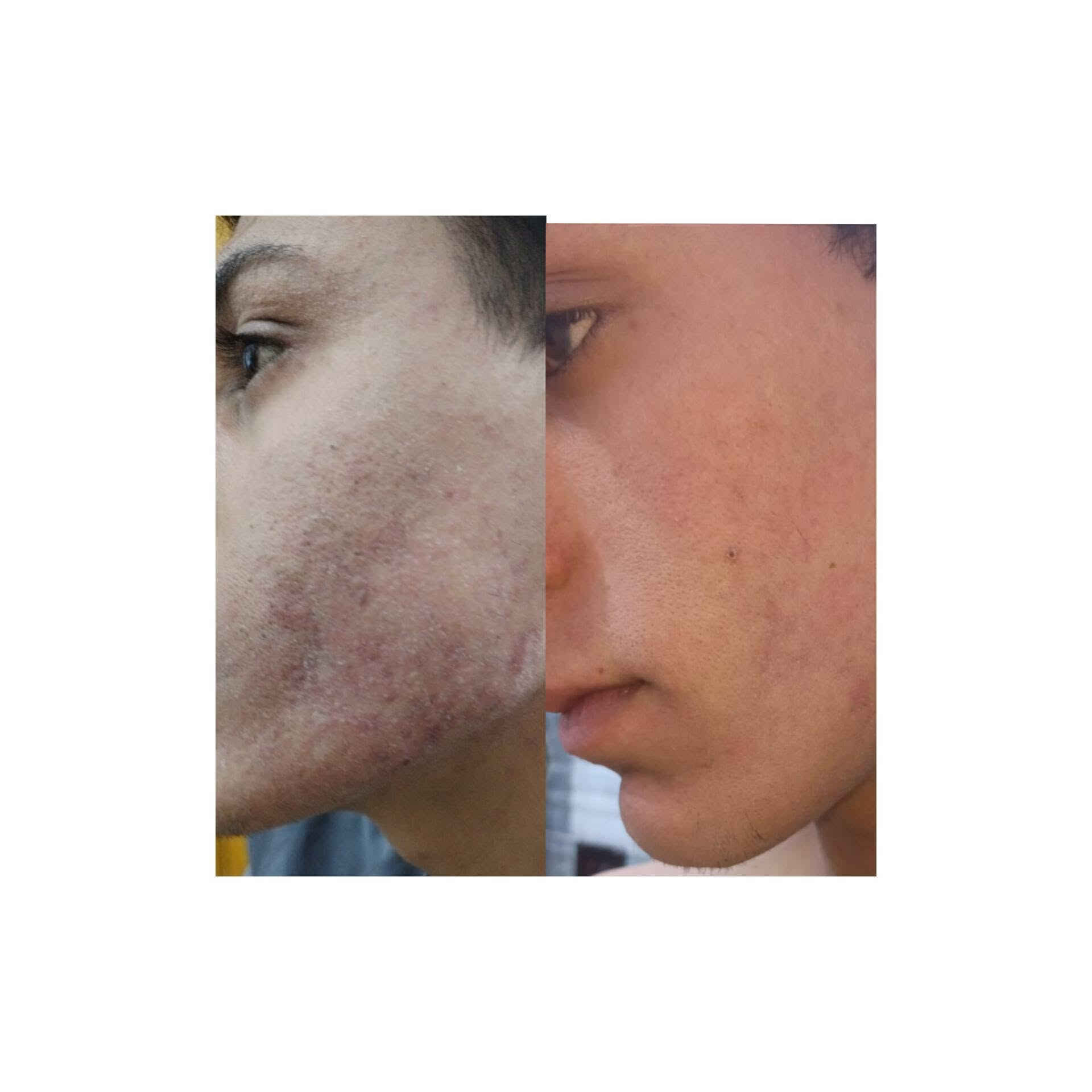 صور تجارب ولتزام بلمنتجات  
متخصصون في لعنايه بلبشره والشعر والجسم وتكون استشارات مجانيه ✨منتجات عاليه الجوده ✨حلول متنوعه لمشاكل لبشره والجسم والشعر ✨منتجات مناسبه للنساء ولرجال
للحجز مراسلة الصفحة على الخاص 
أو مراسلة الرقم وتساب ***********
التوصيل داخل بسمايه  الف 
توصيل بغداد 5
