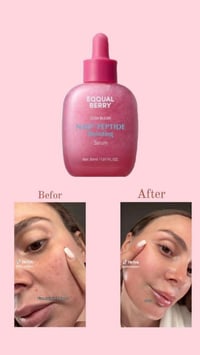 سيروم اكوال الوردي • مضاد تجاعيد • كوريا