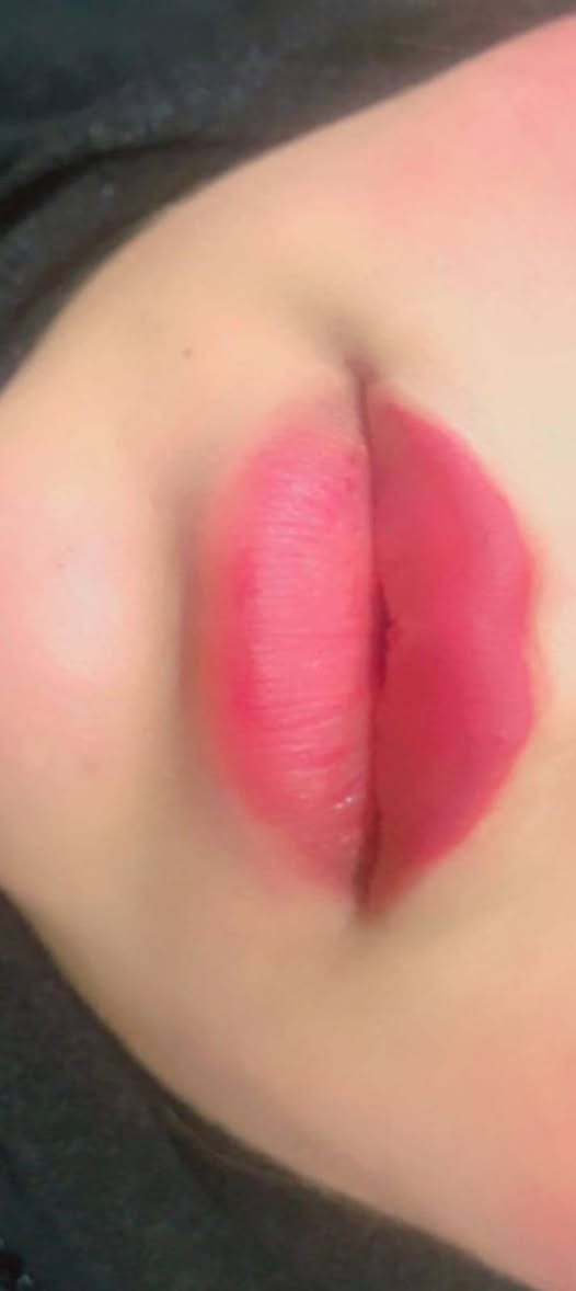 تعلن عيادات إبرو لطب الاسنان وتجميل عن عروض وتخفيضات مكان العياده ماجديه نهاية شارع الجامع مقابيل مأكولات البيك ***********
