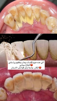 جامعة بابل • كلية طب الاسنان • حجز