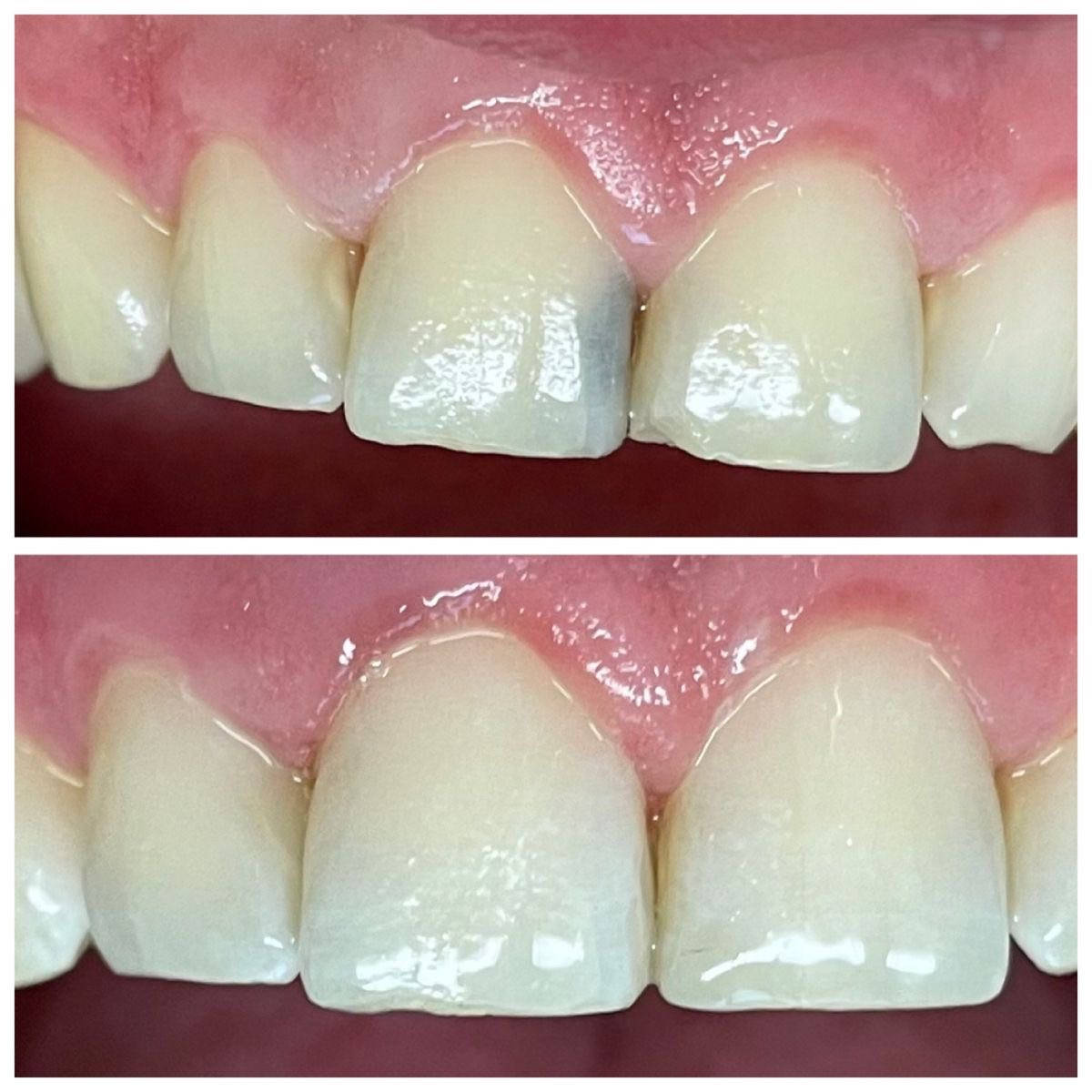 الي عندة مثل هذه الحالات يراسلني نشتغلها مجاني بعيادات جامعة القادسية 👇🏻✨


**إذا كنت صاحب هذا الإعلان وتريد حذفه لأي سبب، رجاءا أرسل رسالة إلى الدعم الفني**