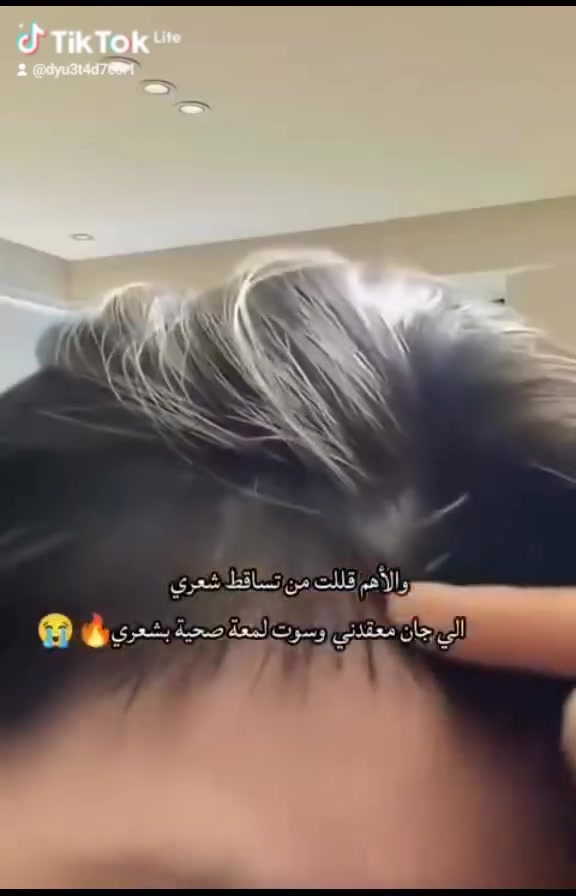 هاشتاك تزيد الانتشار♥️
#viralpost
#tiktokfamous
#featureme
#trend
#levelup
#new
#like
#share


**إذا كنت صاحب هذا الإعلان وتريد حذفه لأي سبب، رجاءا أرسل رسالة إلى الدعم الفني**