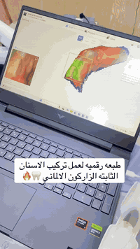 طبعة رقمية • تركيب ثابت • الحله شارع الاطباء