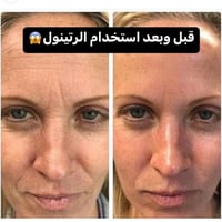 سيروم ريتينول • ترطيب مكثف • توصيل بسمايه