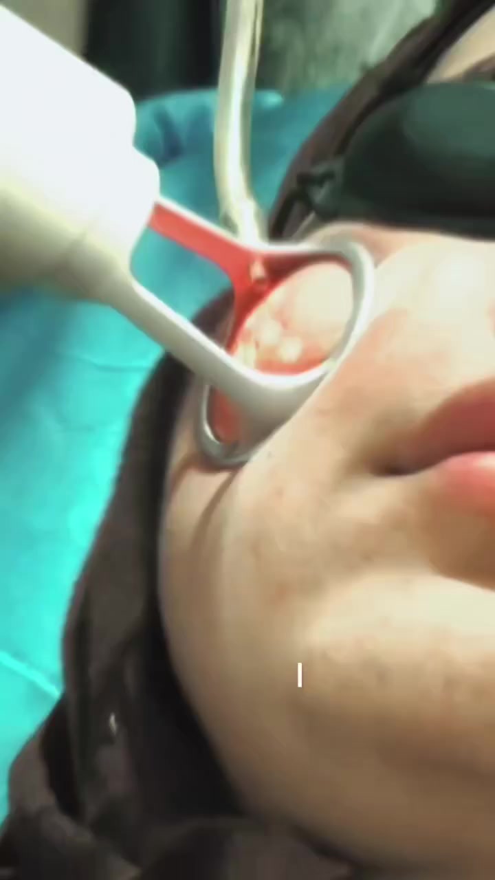 دكتور علي سمير وتوت 
بابل/ جبلة
شارع الاطباء 
مجمع روما الطبي 
عيادة روما للأمراض الجلدية والتجميل 
للحجز والاستفسار:‏‪***********‬‏
