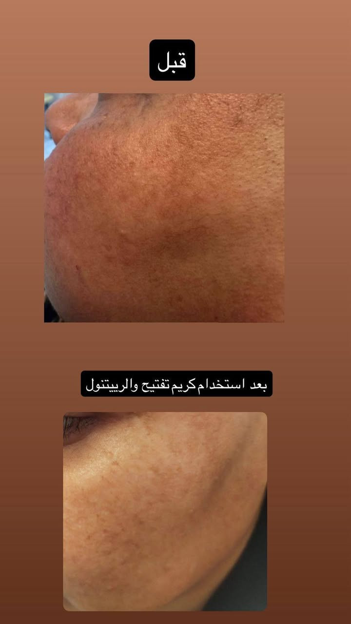 بنات هدا المختبر بالعسكري مدارس مسوي عروض على كافه  تحاليل وعدهم منتجات هولنديه اصليه للبشره والشعر


**إذا كنت صاحب هذا الإعلان وتريد حذفه لأي سبب، رجاءا أرسل رسالة إلى الدعم الفني**