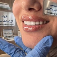بعض من إبداعاتنا التي زرعناها بإطلالتكم وعكست جاذبيتكم وجمالكم بصورة أ...