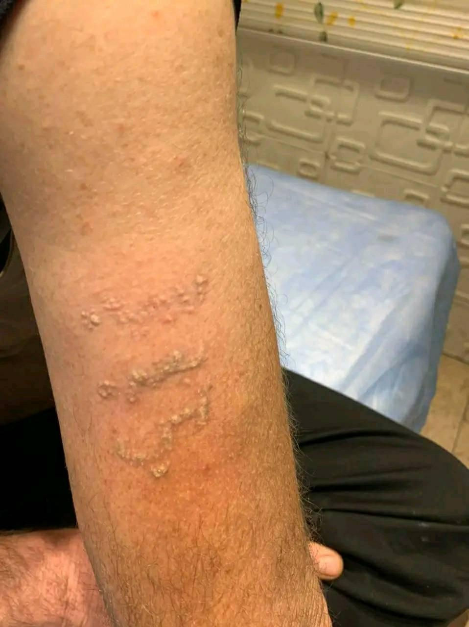 مستعدون لإزالة جميع انواع الوشوم القديمة والحديثة بأحدث الأجهزة 
البصرة الجمهورية تقاطع معهد النفط قرب الريان سنتر للألعاب فوق قاعه الكوكب للرشاقة الطابق الثالث مصعد اكو *********** اتصال وواتساب البصرة, العراق
