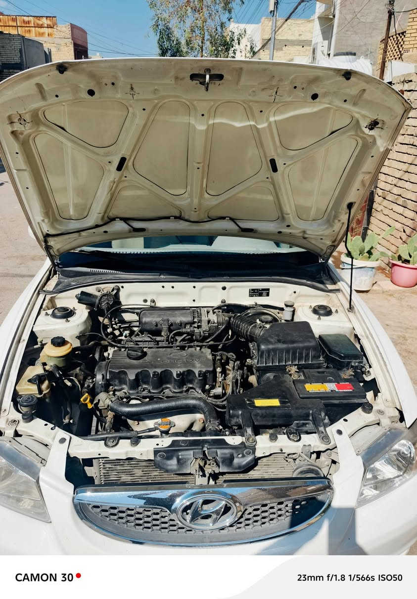 سلام عليكم
هونداي فيرنا خصوصي ابيض موديل ٢٠١٤ مكفوله باسمي تحويل ثاني يوم محرك جيد جدٱ لاتنقيص ولاتبخير كير وتبريد خير من الله السياره فقط الدعاميه الاماميه مصبوغه والباقي مكفول السياره ماشيه ١٩٠ كم المكان زعفرانيه اربع شوارع،، مبايل *********** السعر ٨٨ ورقه
