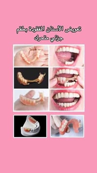 أنا طبيبة أسنان –  وأعمل حاليًا على بحث متخصص في الأطقم الجزئية المتحر...