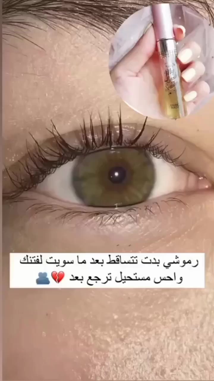 بنات هذا السيروم يخلي الرموش مكناسه حقيقه


**إذا كنت صاحب هذا الإعلان وتريد حذفه لأي سبب، رجاءا أرسل رسالة إلى الدعم الفني**