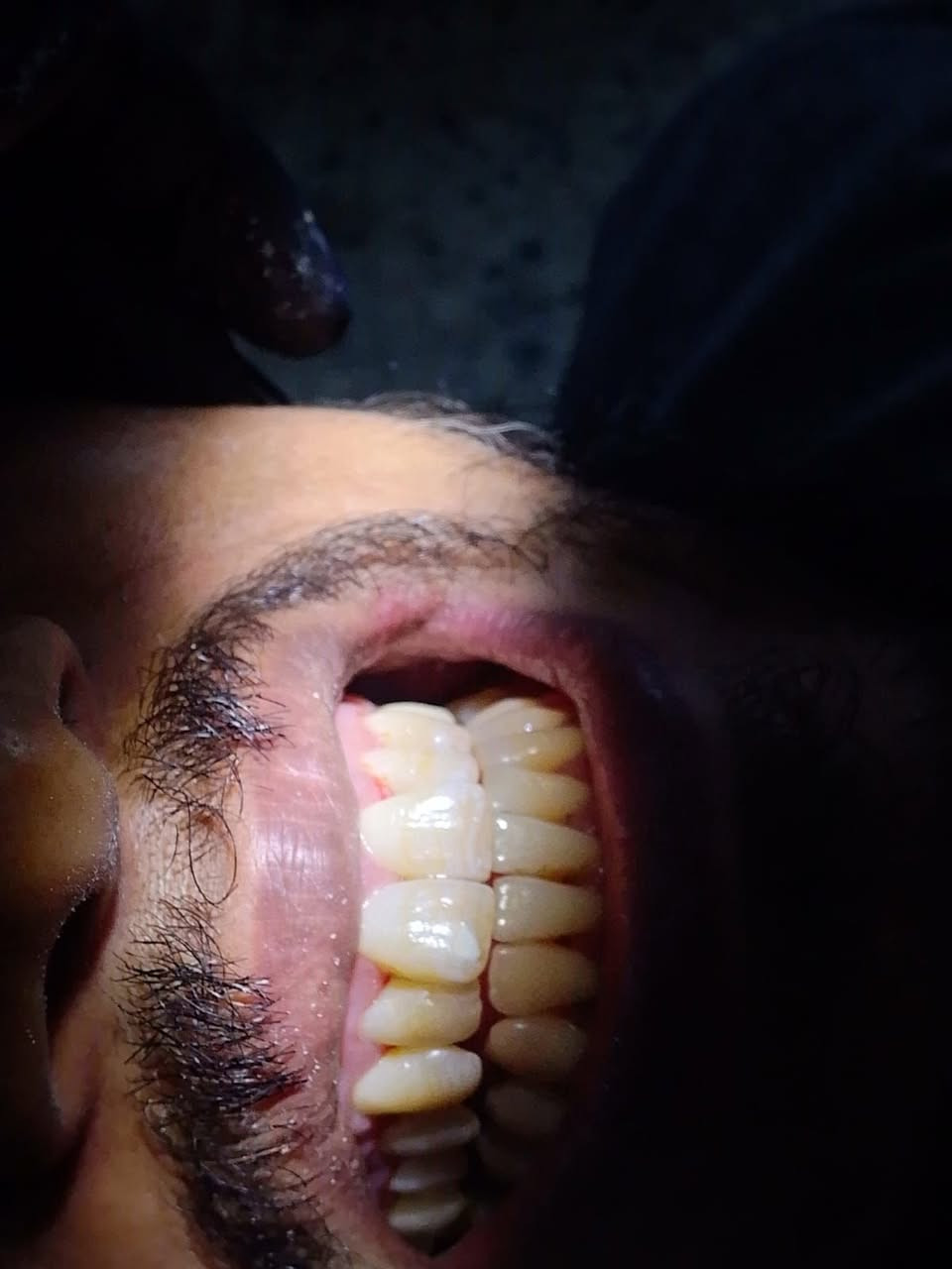 تنظيف الاسنان من التكلسات vip
ابتسامتك صحيه وبجلسه وحده 

الموقع/ حي 17 الشارع العام لمكتبة المهندس مجاور لمدرسة المشاعل

للحجز والاستفسار/ ***********

 متواجدين بلعيادة يومياَ  10صباحاَ لغاية 10مساءاَ
