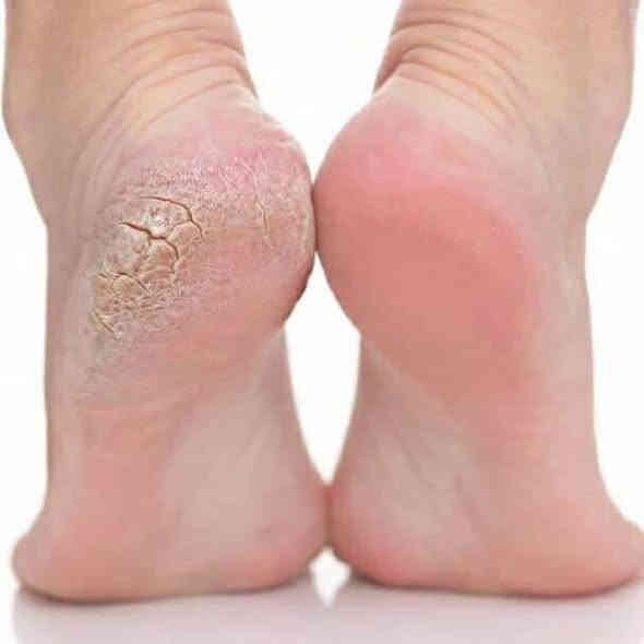 ئامێری لابردنی دڕی و زبری و قلیشاوی قاچ
ماركەی فلەولێسی 
بۆ زانیاری زیاتر پەیوەندی بەم ژمارەیەوە بكە 
*********** أربيل
