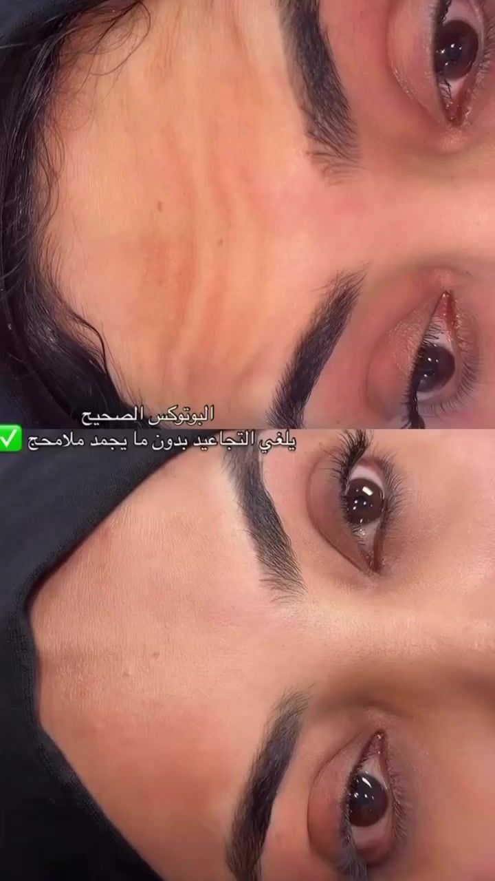 تعلن عيادات إبرو لطب الاسنان وتجميل عن عروض وتخفيضات مكان العياده ماجديه نهاية شارع الجامع مقابيل مأكولات البيك ***********
