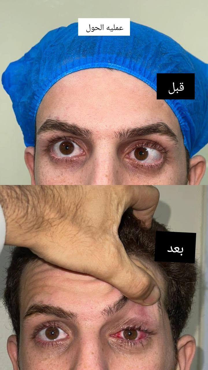 📢اعلان تواجد دكتور قاسم
_اختصاص طب وجراحة العيون _مستشفى ابن الهيثم 

🕛يوم الاربعاء الساعه 3عصراً
في العياده _الحصوه/قرب مرطبات التفاحه 

📞من الآن يتم الحجز 
للحجر والاستفسار يرجى الاتصال على الرقم
***********
