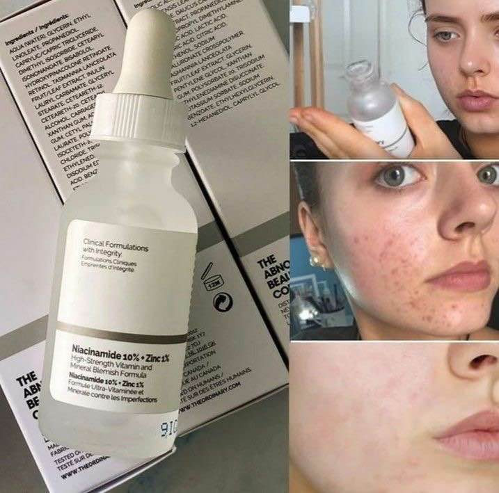 سيروم The Ordinary Niacinamide 10% + Zinc 1%
يساعد على تقليل مظهر المسام، يخفف الدهون الزائدة، يوحّد لون البشرة تدريجياً، ويمنح البشرة صفاءً ونضارة مع الاستمرار على استخدامه. ✨

إذا بشرتج مختلطة أو دهنية، فهو من أفضل سيرومات النياسيناميد . بغداد, العراق


**إذا كنت صاحب هذا الإعلان وتريد حذفه لأي سبب، رجاءا أرسل رسالة إلى الدعم الفني**