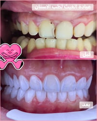 عيادة الغيث • تخفيضات • اسنان وتجميل
