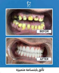 طب الأسنان • عيادة أسنان • البصرة الفاو