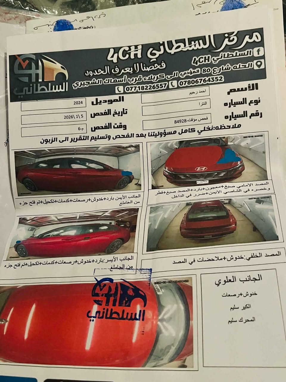 للبيع النترا  2024
بدون رقم
 
محرك 2000 

بصمه

رادار امامي

رادار خلفي

رادار جانبي

شاشة متصل

كامرة دوارة

تحديد مسار

قيادة ذاتيه

توقف ذاتي 

سيارة جاهزة وكاملة بدون نقص
 #وسونار وياه
 للاستفسار***********
