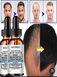 سيروم شعر • تقليل تساقط • مينوكسيديل