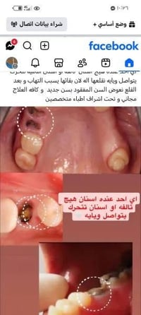 سوناته ٢٠٠١ • رقم كركوك • محرك 16
