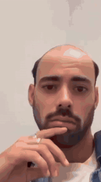 زرع شعر • ضمان مدى الحياة • تقنية OSL والسفير