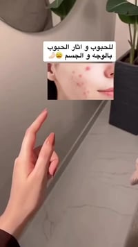 بانوكسيل • بنزويل بيروكسايد ١٠٪ • غسول رغوي حب الشباب