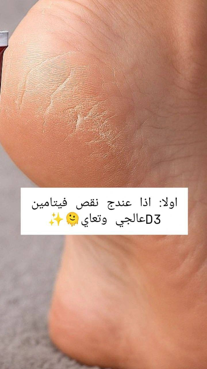 متوفرات حاليا و يوجد توصيل لكافة محافظات العراق للتواصل دايريكت


**إذا كنت صاحب هذا الإعلان وتريد حذفه لأي سبب، رجاءا أرسل رسالة إلى الدعم الفني**