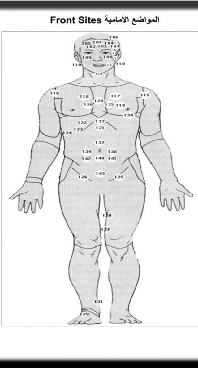 بسم الله الرحمن الرحيم 
قال رسول الله (ص) (ان  أفضل ما تداويتم به الحجامة، أو هو من أمثل دوائكم) 
( إن كان في شيء, من أدويتكم - أو يكون في شيء, من أدويتكم خير ففي شرطة محجم, أو شربة عسل,، أو لذعة, بنار, توافق الداء، وما أحب أن أكتوي) 
يسرنا عن علاج اغلب ومعظم الحالات المرضية بالاساليب العلمية المتطورة منها علما ان الحجامة الوقائية  ( 5000)
والحجامة المرضية ١٠ الف 
١-  علاج خشونة الركبة
٢_  علاج عرق النسا
٣_ علاج النقرس
٤_ علاج خشونة المفاصل 
٥_ علاج الذئبة الحمراء 
٦_ علاج الروماتيد ( التهاب المفاصل) 
٧_ الشلل النصفي الطولي 
٨_ الصداع 
٩_ التبول اللاارادي 
١٠_ خمول المخ 
١١_ التخلف العقلي 
١٢_ الصرع 
١٣_ التهاب الاعصاب الطرفية 
١٤ _ الشلل الوجهي ( التهاب العصب السابع) 
١٥ _ مرض السكري 
١٦_ التهاب المرارة
١٧_ قرحة المعدة 
١٨_ علاج الضغط المرتفع 
١٩_ علاج الامساك 
٢٠ _ علاج الاسهال 
٢١_ علاج القولون العصبي 
٢٢__ علاج التهاب الكبد الفايروسي 
٢٣_ امراض القلب 
٢٤ _ تضخم الغدة الدرقية وزيادة افرازها 
٢٥_ التهاب البروستات 
٢٦_ علاج دوالي الخصية 
٢٧_ علاج الناسور الشرجي 
٢٧_ علاج البواسير 
٢٨_ علاج دوالي الساقين 
٢٩_ التهاب الاذن الوسطى 
٣٠_التهاب الجيوب الانفية 
٣١_ التهاب الحنجرة 
٣٢_التهاب اللوز
٣٣_ الامراض الصدرية 
٣٤_ علاج الثعلبة (القراع) 
٣٥_ علاج البهاق البرص 
٣٦_ علاج الضعف الجنسي 
٣٧_ علاج عقم الرجال 
٣٨ _ علاج امراض العين 
٣٩_ صعوبة النطق 
٤٠_ علاج العصب الخامس
العنوان الهوير _ فلكة الخاص 
هاتف : ***********
