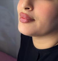 فيلر شفة • كوري • عرض العيد