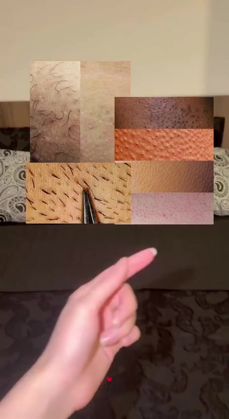 شتی تایبتم لایە بینیری ستۆری بە🥰


**إذا كنت صاحب هذا الإعلان وتريد حذفه لأي سبب، رجاءا أرسل رسالة إلى الدعم الفني**
