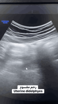 تتواجد غدا السبت ان شاء الله الدكتورة نهى فارس عطااللة الجبوري اخصائية الاشعة التشخيصية دكتوراه بورد عربي زميلة المجلس العربي للاختصاصات الصحية 
سونار ودوبلر ومفراس ورنين 
سونار ودوبلر اوردة وشرايين العنق 
سونار ودوبلر اوردة وشرايين الاطراف العليا 
سونار ودوبلر اوردة وشرايين الاطراف السفلى لكشف التخثر والدوالي 
سونار ودوبلر العضلات والمفاصل 
سونار الثدي وسونار الغدد 
سونار الدماغ للأطفال وسونار الخلع الولادي 
سونار الجلد وسونار العين 
يوجد في العيادة اشعة ملونة لفتح الانابيب 
عنوان العيادة القيارة شارع البيكمات مجمع الكوثر الطبي مقابيل روتانا مول 
اوقات دوام العيادة من الساعة الواحدة ضهرا إلى الساعة السابعة مساءا 
يوم السبت ويوم الأربعاء من كل اسبوع 
للحجز والاستفسار الاتصال على رقم العيادة ***********
