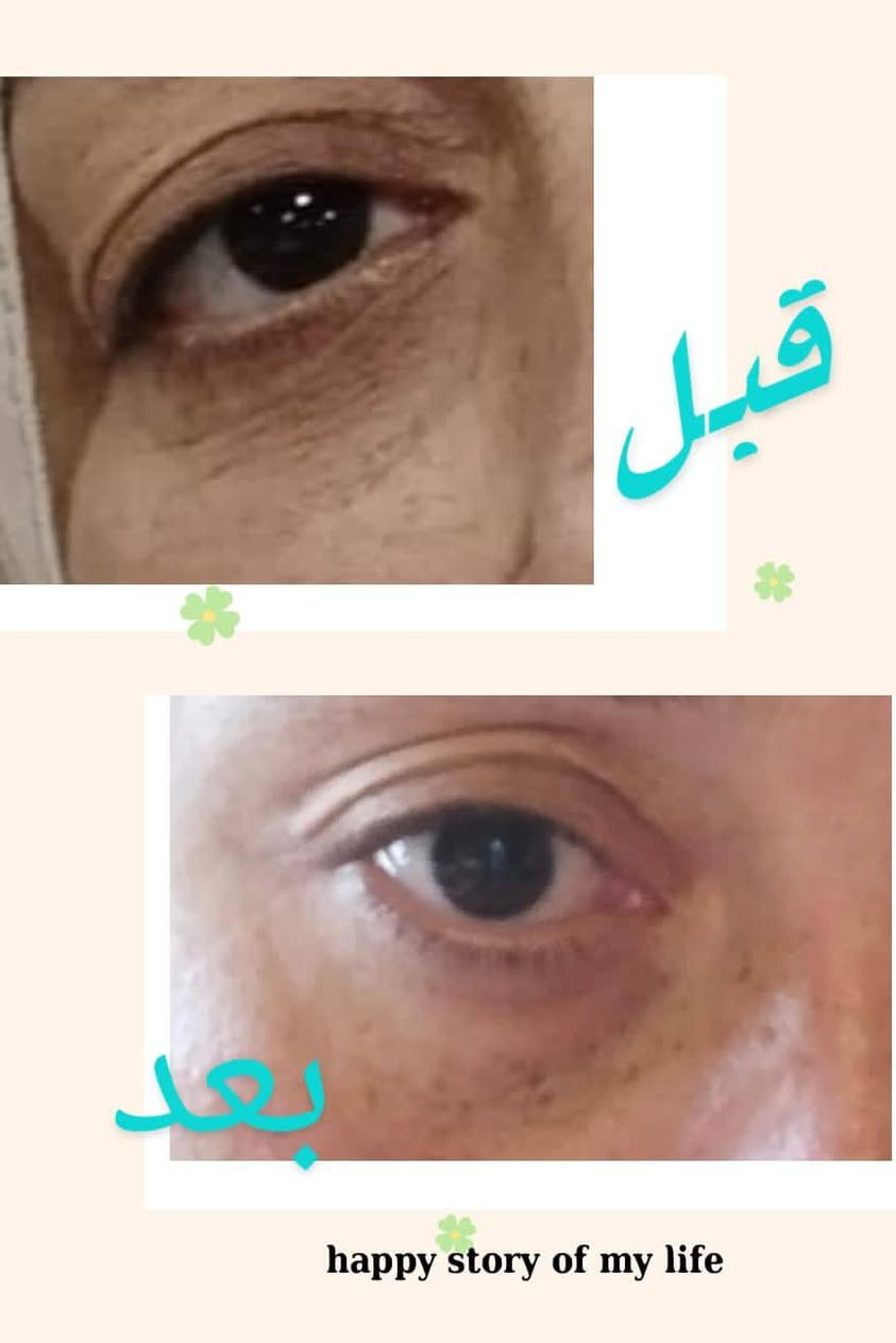صور تجارب ولتزام بلمنتجات  
متخصصون في لعنايه بلبشره والشعر والجسم وتكون استشارات مجانيه ✨منتجات عاليه الجوده ✨حلول متنوعه لمشاكل لبشره والجسم والشعر ✨منتجات مناسبه للنساء ولرجال
للحجز مراسلة الصفحة على الخاص 
أو مراسلة الرقم وتساب ***********
التوصيل داخل بسمايه  الف 
توصيل بغداد 5
