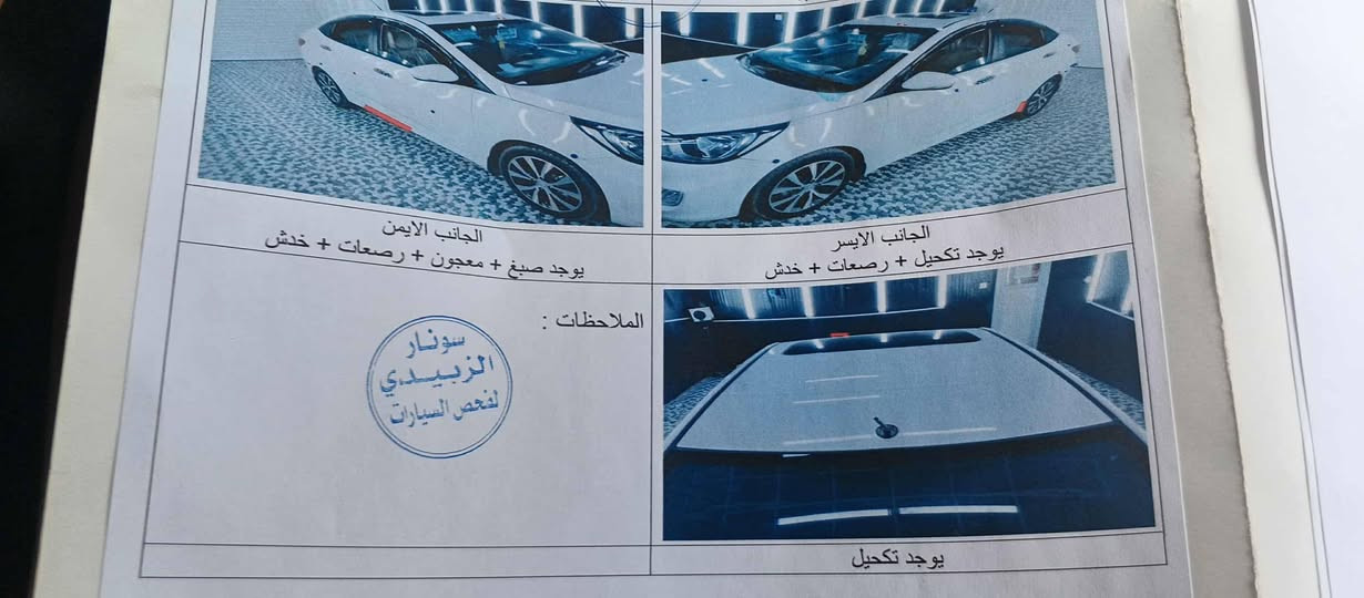 سلام عليكم اكسنت موديل 2014 كفاله عامه مدور ثاني يوم السعر 92 رقم الهاتف ***********
