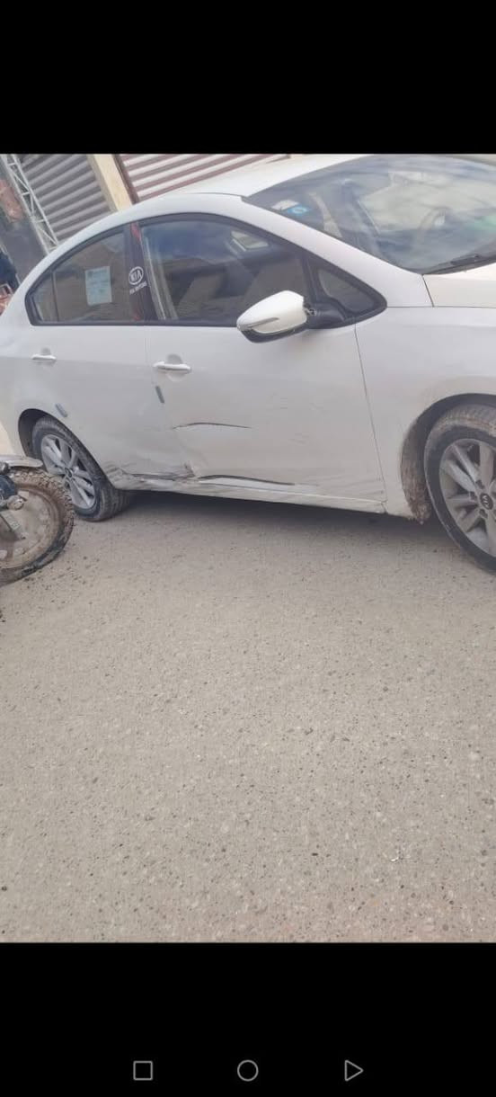 سيراتو موديل 17 رقم بصره بسمي مكان سياره سماوه قضاء الرميثه  كير محرك شرط ماشيه 151 
ضرر تبديل بنيد  السعر 122سونار سياره موجود تفاصيل أكثر *********** ملاحضه اقصاد مابيع ومراوس ماراوس  بيع فقط بيع فقط محرك شرط مامفتوح اخوان الضربه مصلحه مال بوب وكلشي واضح كدامكم
