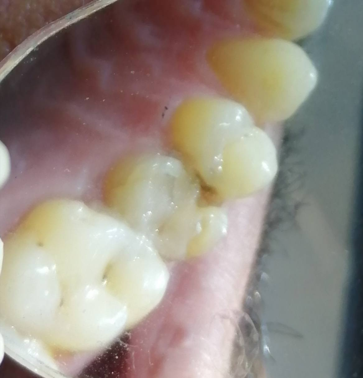 د مهند عبد الجواد الطحان الهاشمي.. ماجستير ودبلوم عالي تعويض الأسنان.. سايدين مستشفى #القيارهالعام.. للحجز والاستفسار التواصل على الرقم ***********# مجاور صيدليه عبدالله المعماري.. طابق ارضى
