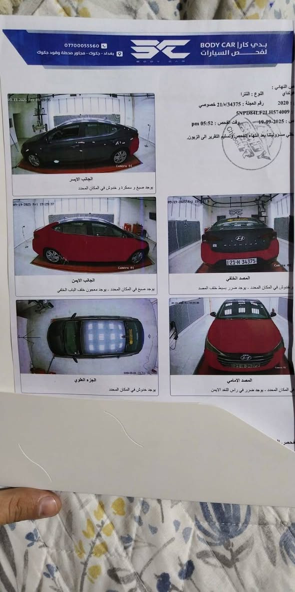 بسعر ماتشوفه بس بالاحلام

🚘 هيونداي إلنترا 2020 | نص فول 🚘

✅ الموديل: 2020
✅ المواصفات: نص فول
✅ الرقم: سليمانية (بأسمي)
✅ التحويل: تحويل أو وكالة (شرط)
✅ الحادث: موضح بالصور، بدون دواخل
✅ المحرك والگير: مكفولات
✅ السيارة: كاملة وما تحتاج أي مصاريف

💰 السعر: اكتب رقم 1

📍 الموقع: ديالى - بعقوبة

📞 للتواصل: ***********

🚗 #كراج عراقي | سوق السيارات الأول 🇮🇶
