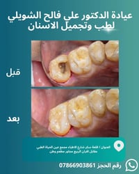 عيادة أسنان • طب أسنان • علاج أسنان • حشوات تجميلية • تسوس أسنان • ابت...