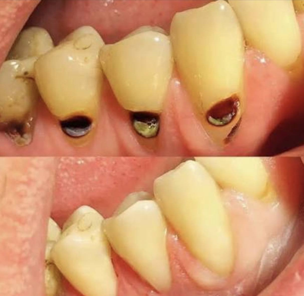 السلام عليكم اي احد عنده هاي الحالات يتواصل وياي العلاج مجاني المكان عيادات جامعه المشرق مقابل ساحة عباس بن فرناس
***********
