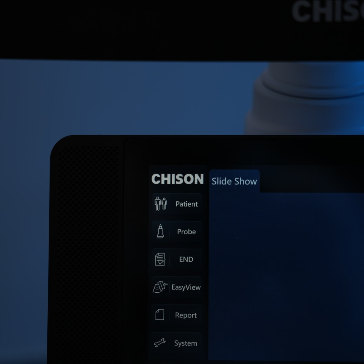 🔷 جهاز Chison CBit 4 — خيار الأطباء الأذكى للتشخيص الدقيق ..

✨ عندما تجتمع التكنولوجيا المتقدمة مع سهولة الاستخدام لتحصل على نتائج أسرع وثقة أكبر في التشخيص.

🔹 المواصفات التقنية المتقدمة:
 ✔️ شاشة LED قياس 19 إنش عالية الدقة
توفر وضوحًا ممتازًا للصورة حتى أدق التفاصيل، مع زاوية رؤية مريحة تقلل إجهاد العين أثناء العمل الطويل.
✔️ محرك المعالجة الذكي X-Engine
يعزز سرعة معالجة الصورة ويحسن التباين والدقة، مما يساعد على تشخيص أكثر وضوحًا وثباتًا.
✔️ تقنية Q-Image المتطورة
تحسين تلقائي لجودة الصورة وتقليل التشويش للحصول على صور أكثر نقاءً بدون تدخل يدوي.
✔️ تقنية C-FHI (Compound Frequency Harmonic Imaging)
تعمل على دمج الترددات لتحسين اختراق الأنسجة ودقة الصورة، خاصة في الحالات الصعبة.
✔️ دوبلر ملون عالي الحساسية
لقياس تدفق الدم بدقة عالية، مثالي لفحوصات الأوعية، البطن، النساء والتوليد، والقلب.
✔️ واجهة استخدام سهلة وذكية
تصميم عملي يختصر وقت الفحص، مناسب للأطباء ذوي الخبرة والمبتدئين على حد سواء.

🔹 مجالات الاستخدام: 
▪️ نسائية وتوليد 
▪️ باطنية وقلبية 
▪️ أوعية دموية
▪️ استخدامات عامة داخل العيادات والمستشفيات

🎁 العرض يشمل:
 ✔️ توصيل مجاني داخل بغداد والمحافظات
✔️ تنصيب احترافي داخل العيادة 
✔️ تدريب عملي شامل لضمان أفضل استخدام
✔️ دعم فني مستمر

📞 للحجز والاستفسار : ***********                أدارة المبيعات / م علياء 

الأحدث — الأكثر مبيعًا — والأفضل في فئته لمن يبحث عن الجودة والاعتمادية بسعر منافس.
#التميّز #Chison #CBit4 #أجهزة_سونار #تشخيص_دقيق_لحياة_صحية_أفضل
